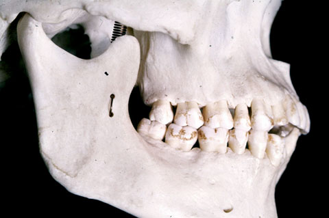 Temporo-Mandibular Joint Disorders